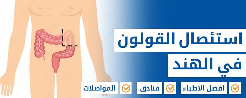 استئصال القولون